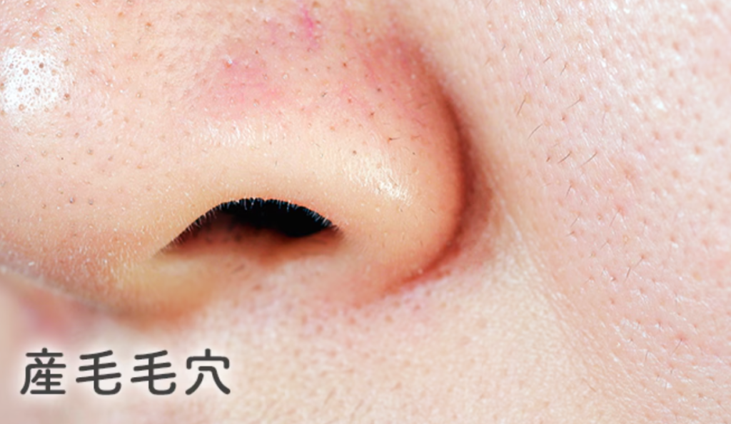 産毛によって黒く見えるタイプ