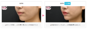 湘南美容クリニック症例