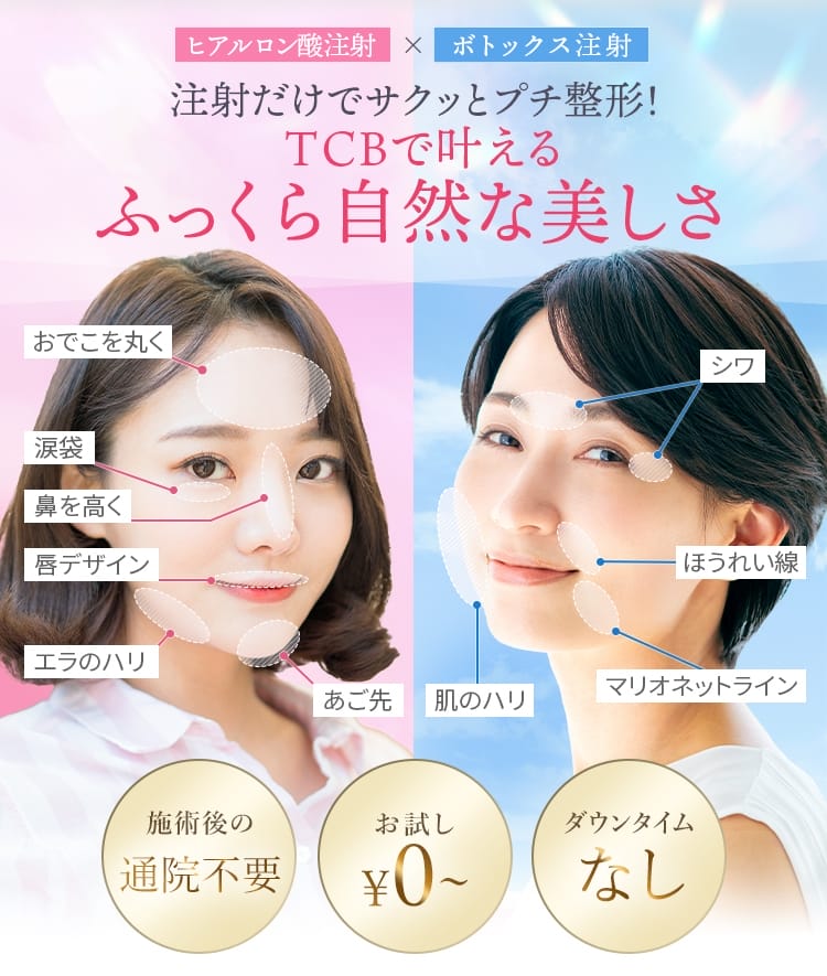 TCBほうれい線ヒアルロン酸FV