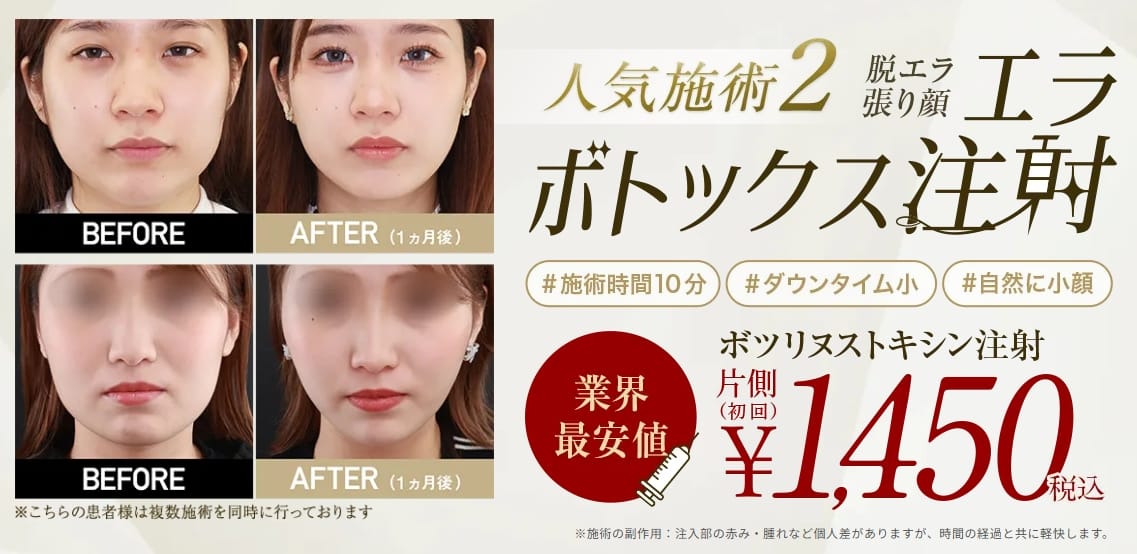 横浜TAクリニックのエラボトFV