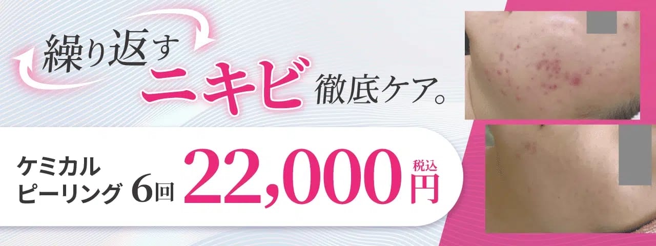 渋谷美容外科クリニックニキビ治療FV