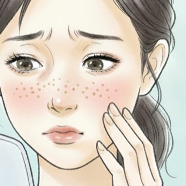 そばかすで悩む女性イメージイラスト