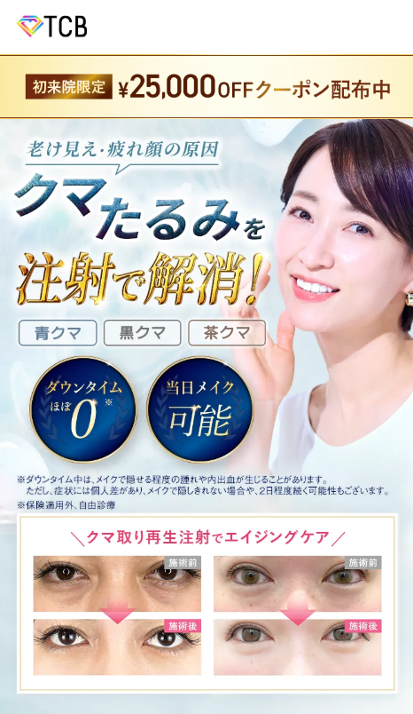 TCBのクマ取り再生注射FVクーポンで初回限定0円