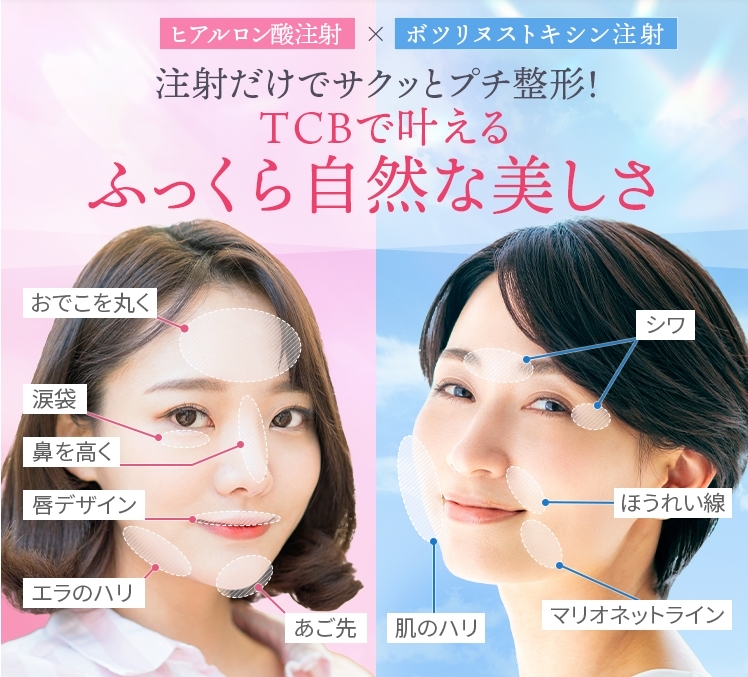 TCBヒアルロン酸FV