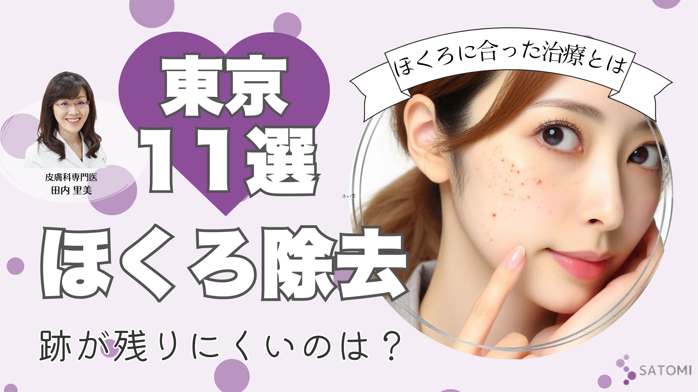 【東京】ほくろ除去が安いおすすめ11選！1個5000円以下で跡が残らない選び方を専門医が解説