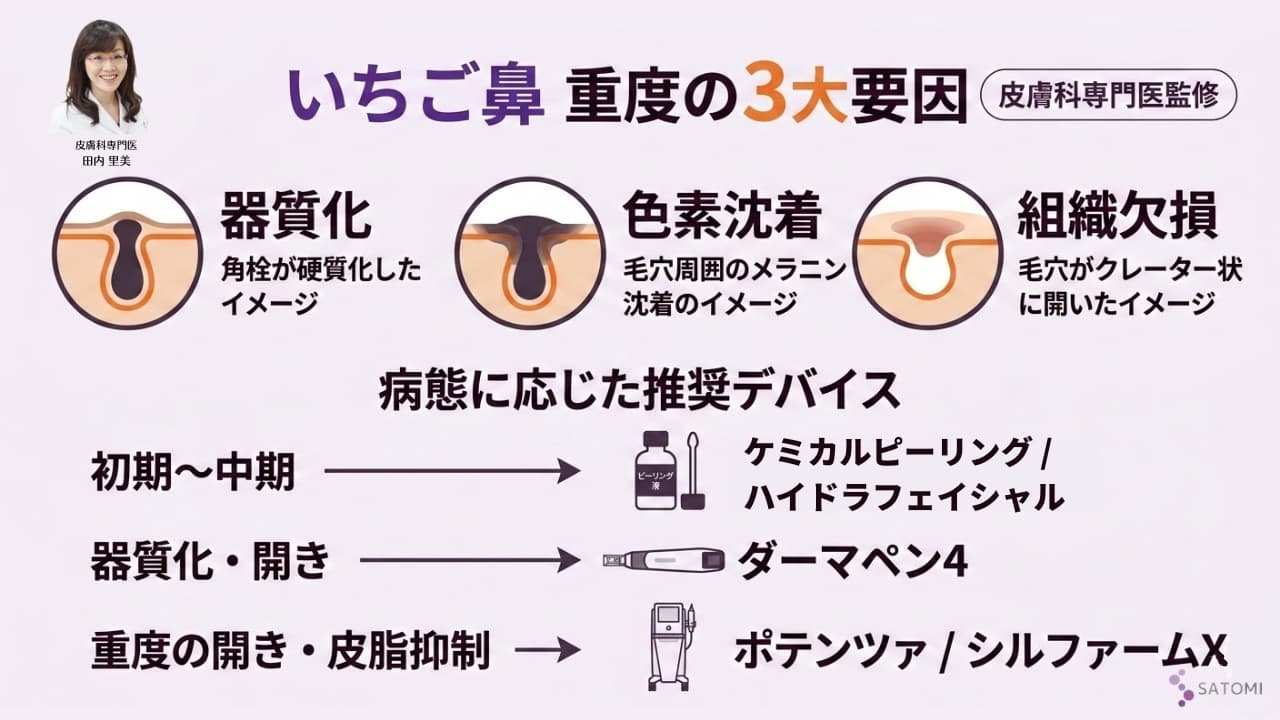 重度のいちご鼻における病態分類（器質化・色素沈着・組織欠損）と治療選択の医学的相関図｜皮膚科専門医監修